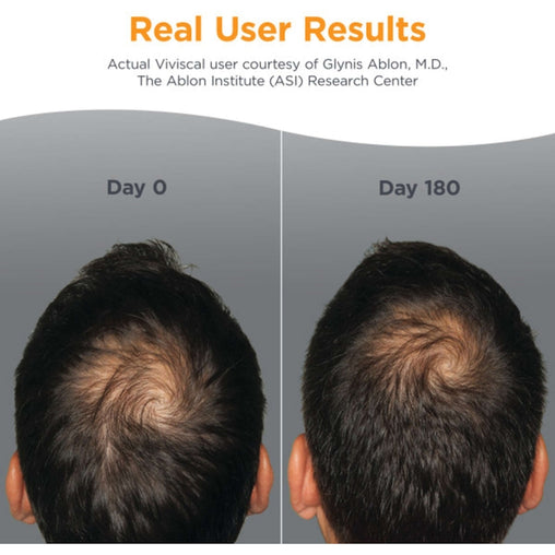 Viviscal Men's Hair Growth Supplement – 60 Tablets