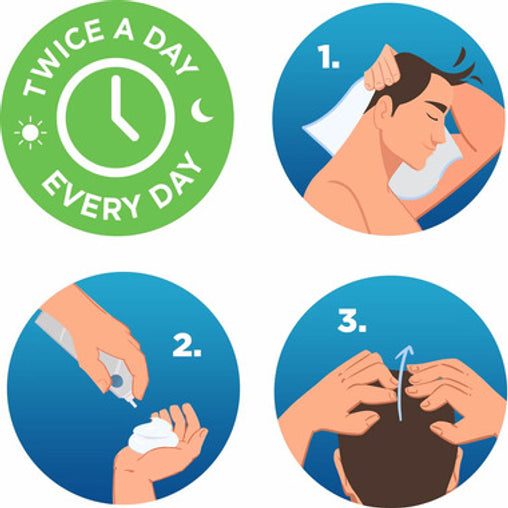 Rogaine Hair Growth Treatment For Men 5% Minoxidil Foam - 3 x 60g