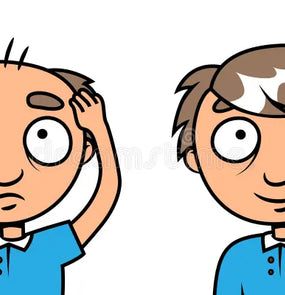 Hair Loss Solutions & Vitamins