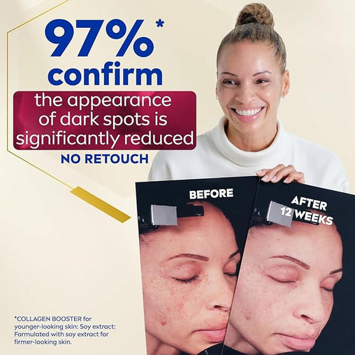 Nivea Luminous630 Dark Spot Solution Anti Wrinkle and Age Spot Serum, 30 mL