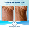 Glaxal Base Moisturizing Cream for Dry & Sensitive Skin – 50g