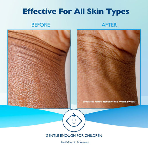 Glaxal Base Moisturizing Cream for Dry & Sensitive Skin – 50g